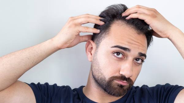 man with thinning hair